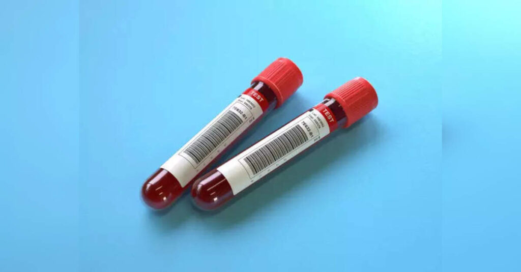 Revolutionary Blood Test Detects Ovarian Cancer Early, Offering Hope for Women, ETHealthworld