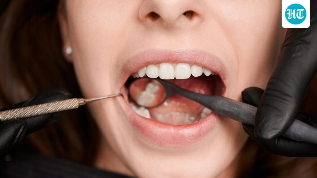 California dentist with 41 years experience shares ‘number 1 cause of cavities’ and exact reason for your bad breath