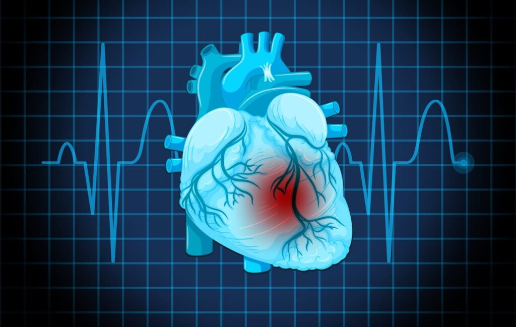 Cardiovascular surgeon distinguishes men vs women heart attack symptoms: ‘Women experience softer symptoms like…’