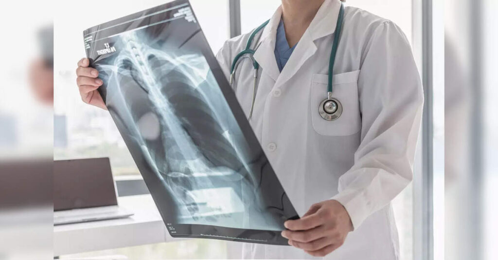 Study estimates 14 pc of adults aged 45, above have obstructive lung disease, ETHealthworld