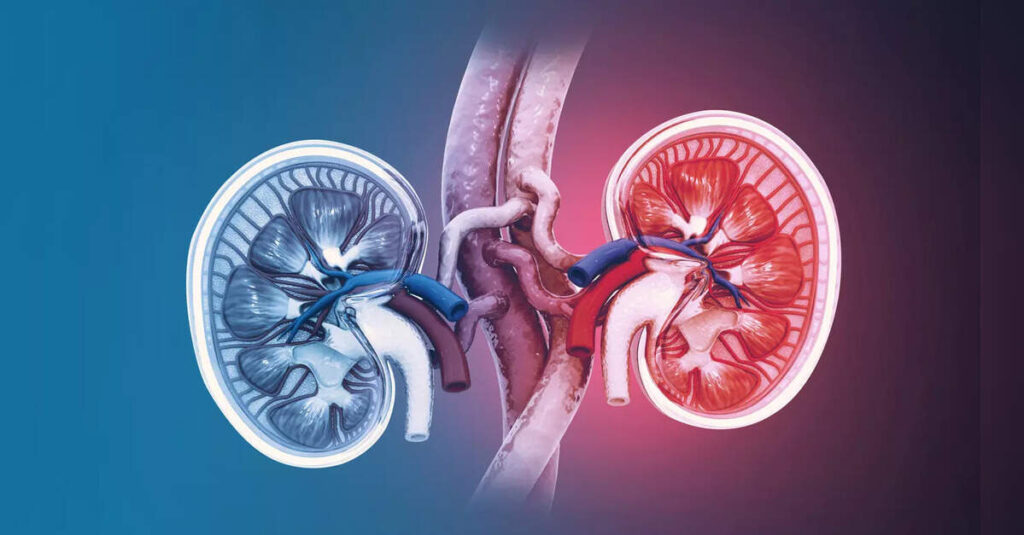 Study projects kidney cancer cases could double in next 25 years globally, ETHealthworld Study projects kidney cancer cases could double in next 25 years globally, ETHealthworld