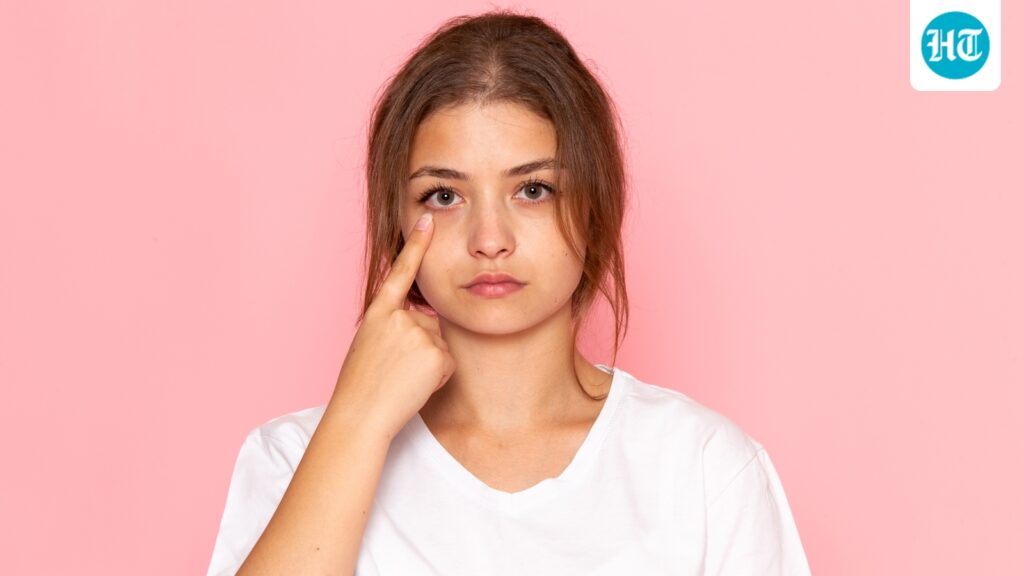 The truth about dark circles: Dermatologist explains causes and home remedies to treat them