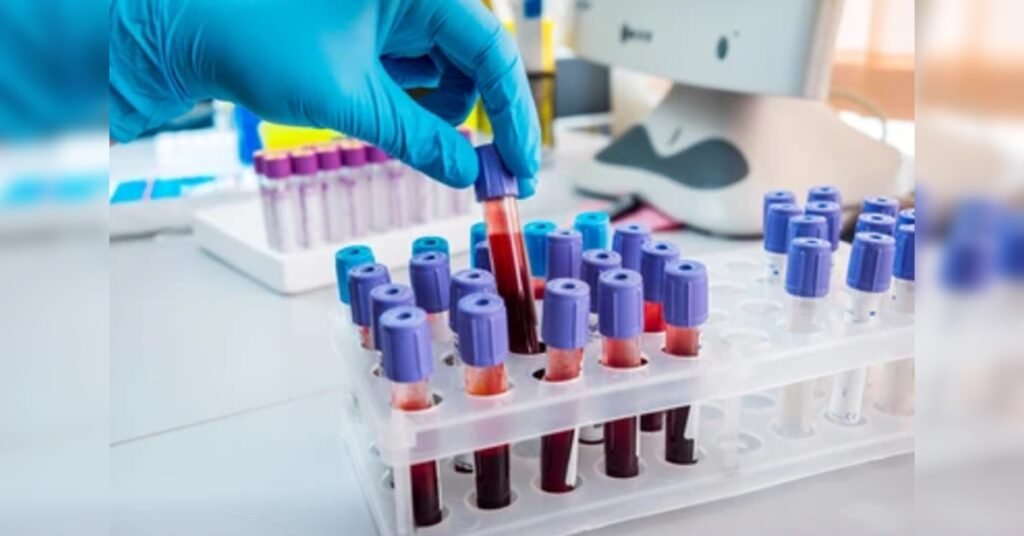 ICMR Develops Revolutionary Multi-Disease Diagnostic Test to Combat Infection Delays, ETHealthworld ICMR Develops Revolutionary Multi-Disease Diagnostic Test to Combat Infection Delays, ETHealthworld