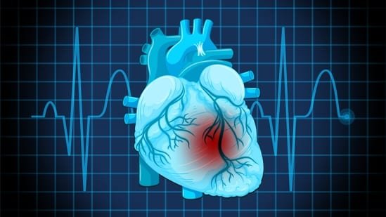 Bengaluru cardiac surgeon explains how to spot sudden cardiac arrest vs heart attack; shares what to do to save lives Bengaluru cardiac surgeon explains how to spot sudden cardiac arrest vs heart attack; shares what to do to save lives