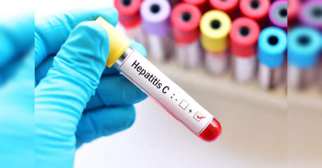 Jaundice Outbreak Claims Seven Lives in Haryana’s Chainsa Village; Investigation Ongoing, ETHealthworld Jaundice Outbreak Claims Seven Lives in Haryana’s Chainsa Village; Investigation Ongoing, ETHealthworld