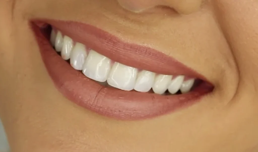 Dental Care: क्या Baking Soda से दांत साफ करना है सही, एक्सपर्ट्स ने बताया पूरा सच