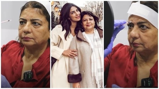 Do you know how Botox injections work? Priyanka Chopra’s mother Dr Madhu shows by demonstrating procedure on herself Do you know how Botox injections work? Priyanka Chopra’s mother Dr Madhu shows by demonstrating procedure on herself