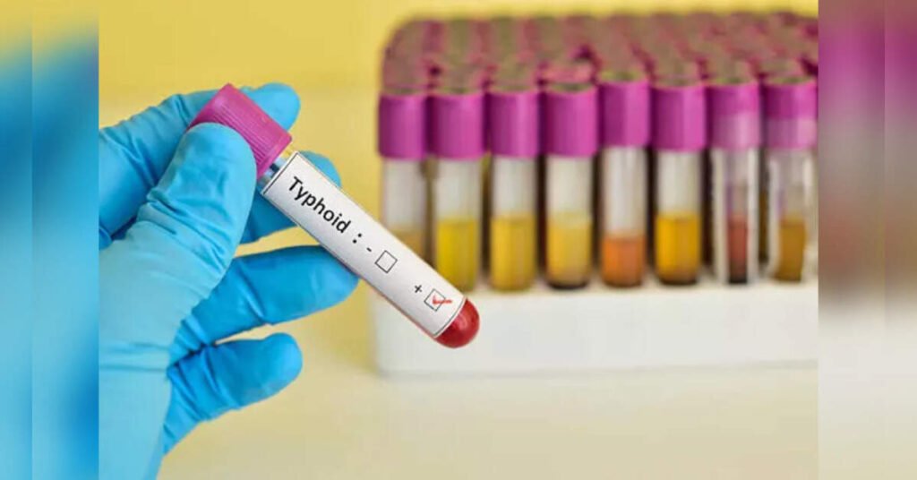 Over 87% of India’s Typhoid Economic Burden Linked to Antibiotic Resistance, Study Reveals, ETHealthworld Over 87% of India’s Typhoid Economic Burden Linked to Antibiotic Resistance, Study Reveals, ETHealthworld