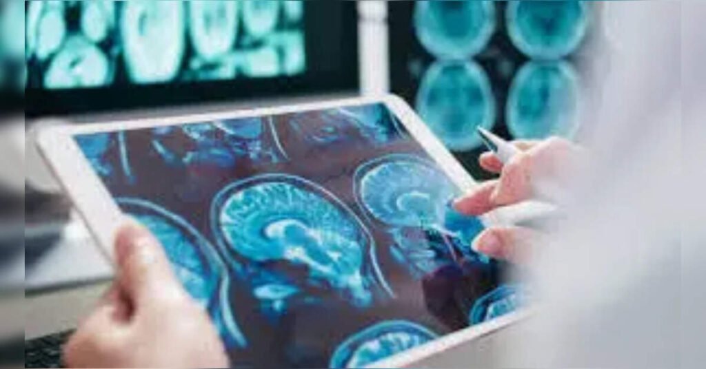 Gut Microbiome Changes May Predict Parkinson’s Disease Risk, ETHealthworld