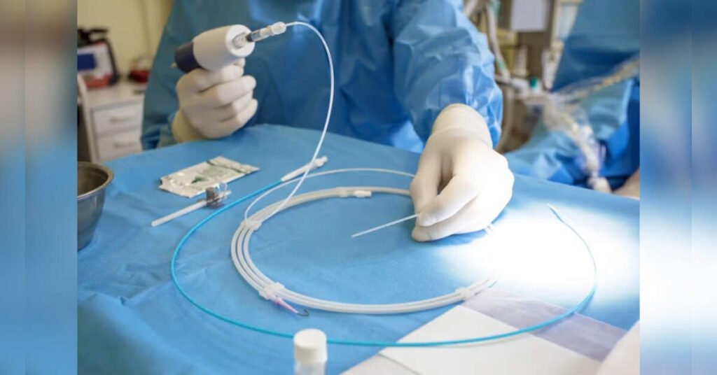 New Procedure for Type 2 Diabetes Shows Promising Weight Maintenance After Stopping GLP-1 Drugs, ETHealthworld