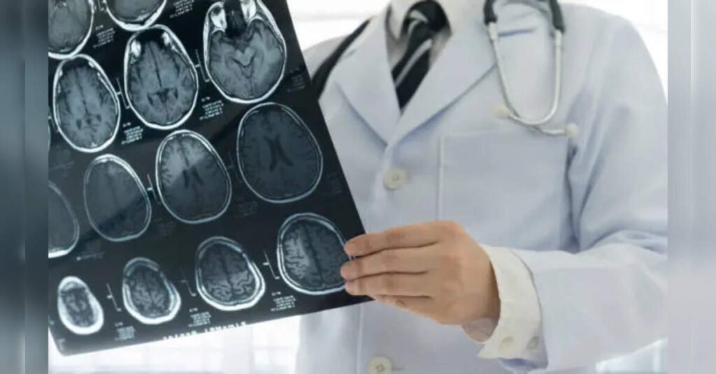New Study Links White Matter Damage to Neurodegenerative Disease Features, ETHealthworld