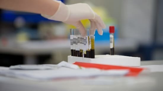 Do routine blood tests tell the full story? Radiologist shares women’s health issues that only imaging tools can detect Do routine blood tests tell the full story? Radiologist shares women’s health issues that only imaging tools can detect