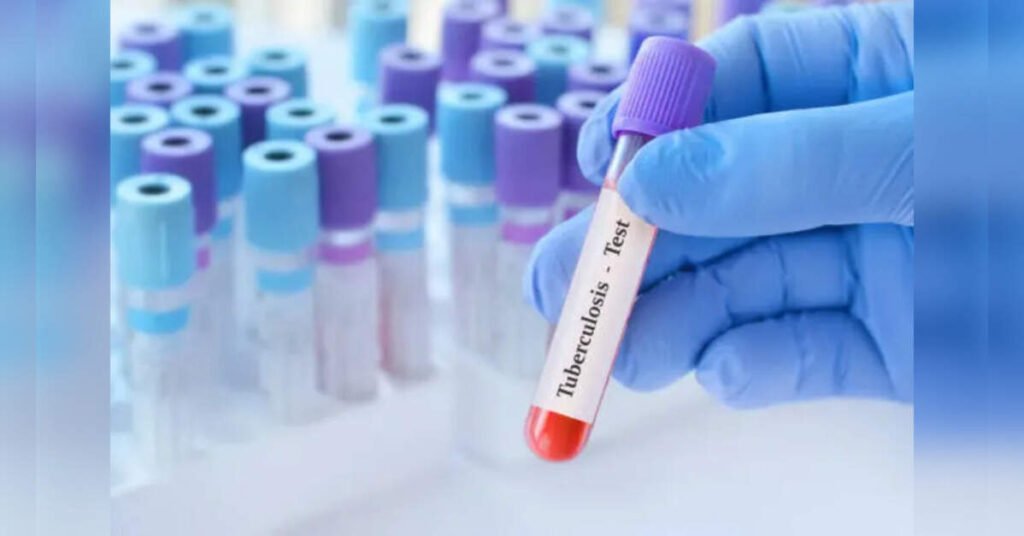 Eliminating undernutrition could prevent up to 2.3 million TB cases globally: Study, ETHealthworld