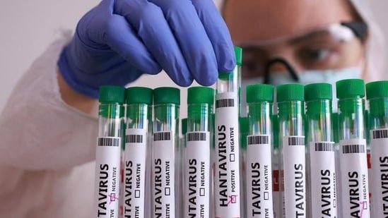 Hantavirus explained: Can it spread from person to person? Bengaluru doctor reveals everything Indians should know Hantavirus explained: Can it spread from person to person? Bengaluru doctor reveals everything Indians should know
