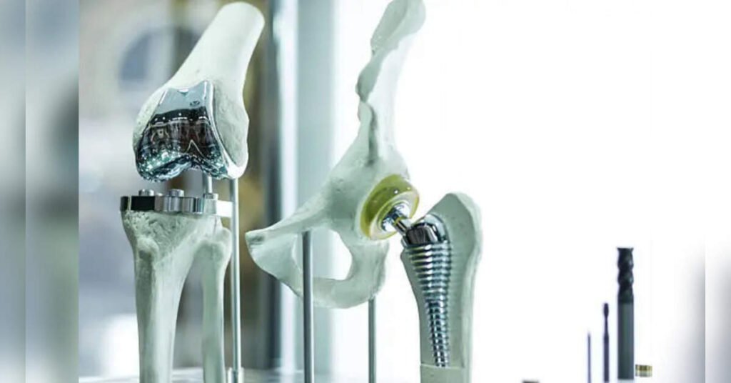 India’s National Registry for Implantable Medical Devices to Enhance Patient Safety, ETHealthworld India’s National Registry for Implantable Medical Devices to Enhance Patient Safety, ETHealthworld