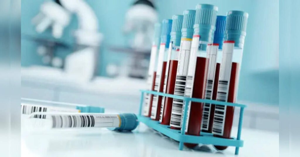 Revolutionary Blood Test Detects Alzheimer’s Signs Decades Early: Groundbreaking Study, ETHealthworld Revolutionary Blood Test Detects Alzheimer’s Signs Decades Early: Groundbreaking Study, ETHealthworld