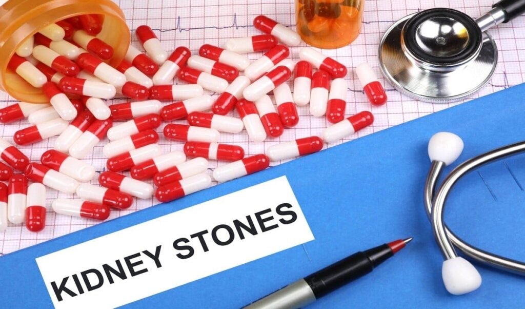kidney stone risk increases by 50 making this mistake while drinking water costly