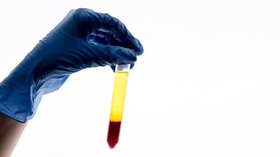 65-year-old man sees unusual urine colour change; Mumbai doctor warns blood is never normal: ‘Even if painless’ 65-year-old man sees unusual urine colour change; Mumbai doctor warns blood is never normal: ‘Even if painless’