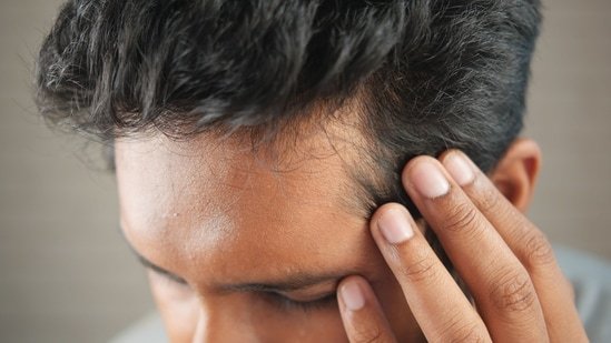AIIMS-trained doctor shares lifestyle factors that lead to increased hair loss in younger people AIIMS-trained doctor shares lifestyle factors that lead to increased hair loss in younger people