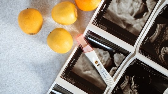 From career growth to personal choice, a gynaecologist explains why egg freezing is on the rise among women in their 30s From career growth to personal choice, a gynaecologist explains why egg freezing is on the rise among women in their 30s
