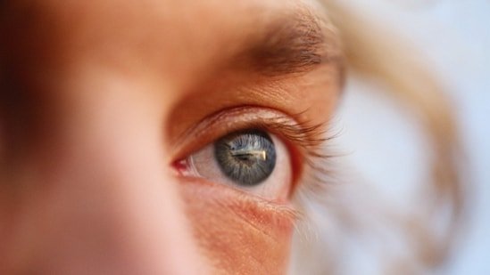 Gurgaon ophthalmologist says watery eyes don’t always mean healthy eyes; dry eye disease could be the hidden cause Gurgaon ophthalmologist says watery eyes don’t always mean healthy eyes; dry eye disease could be the hidden cause