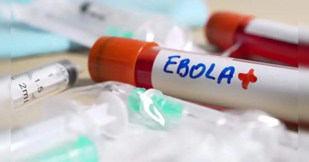 Second Sudanese National Tests Negative for Ebola in Hyderabad Hospital, ETHealthworld Second Sudanese National Tests Negative for Ebola in Hyderabad Hospital, ETHealthworld