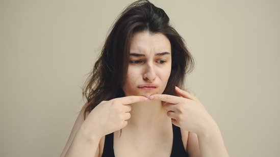 These 6 non-greasy moisturisers for acne-prone skin let your skin breathe without clogging pores These 6 non-greasy moisturisers for acne-prone skin let your skin breathe without clogging pores