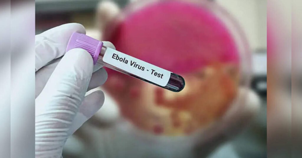 Ugandan National in Jaipur Under Observation After Showing Symptoms, ETHealthworld