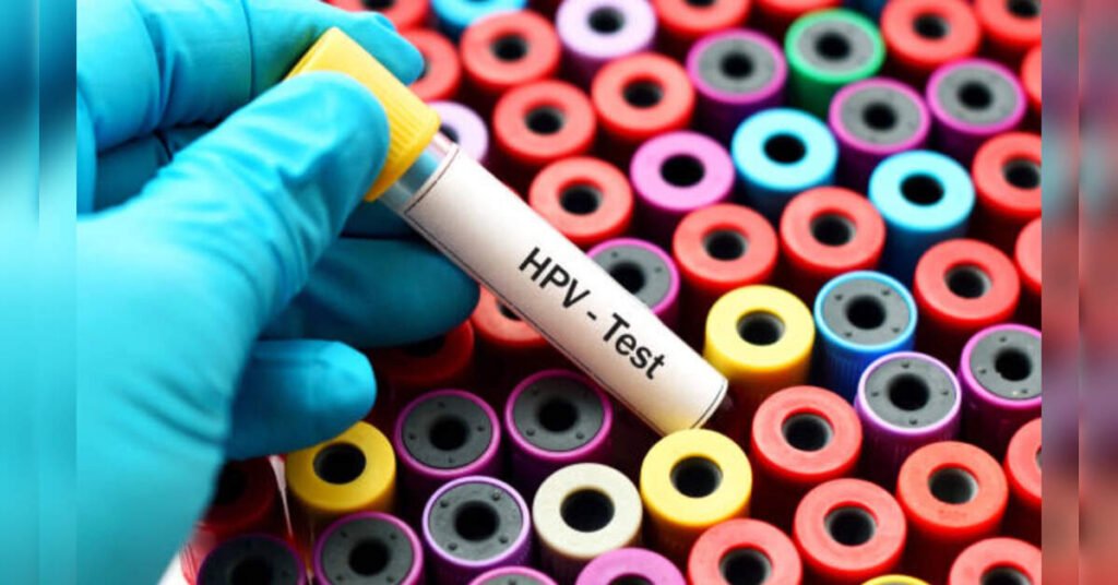 India Should Adopt HPV DNA Testing for Effective Cervical Cancer Screening, Dr. Neerja Bhatla, ETHealthworld India Should Adopt HPV DNA Testing for Effective Cervical Cancer Screening, Dr. Neerja Bhatla, ETHealthworld