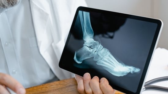 Persistent bone pain? Oncologist Dr Saurabh Gupta shares the early signs of bone cancer that shouldn’t be ignored Persistent bone pain? Oncologist Dr Saurabh Gupta shares the early signs of bone cancer that shouldn’t be ignored