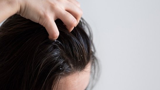 Sweaty and itchy scalp this summer? Dermatologist shares easy tips to keep it healthy Sweaty and itchy scalp this summer? Dermatologist shares easy tips to keep it healthy