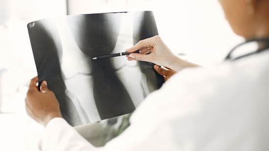 What are the early symptoms of bone cancer? Ortho oncologist Dr Nikhil Tandon explains What are the early symptoms of bone cancer? Ortho oncologist Dr Nikhil Tandon explains