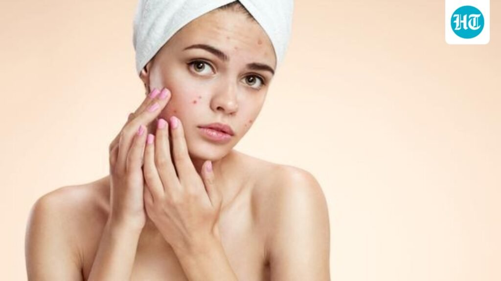 Dermatologist Dr Rinky Kapoor says sensitive skin is for real and explains 1/3rd of Indians’ skin can’t handle skincare