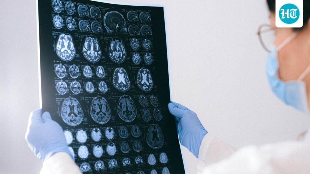 Do mobile towers cause brain tumours? Oncologist Dr Sunny Jain explains the truth about cellphone radiation Do mobile towers cause brain tumours? Oncologist Dr Sunny Jain explains the truth about cellphone radiation