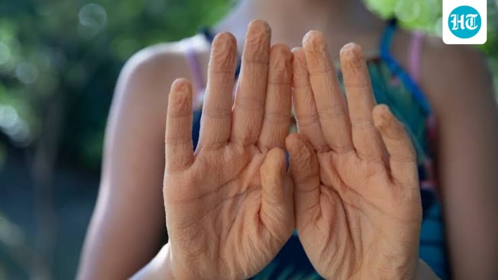 Everyday explained: Why do your fingers wrinkle in water?