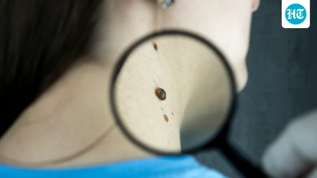 From size and location to changes over time: Oncologist explains when a lump needs attention From size and location to changes over time: Oncologist explains when a lump needs attention