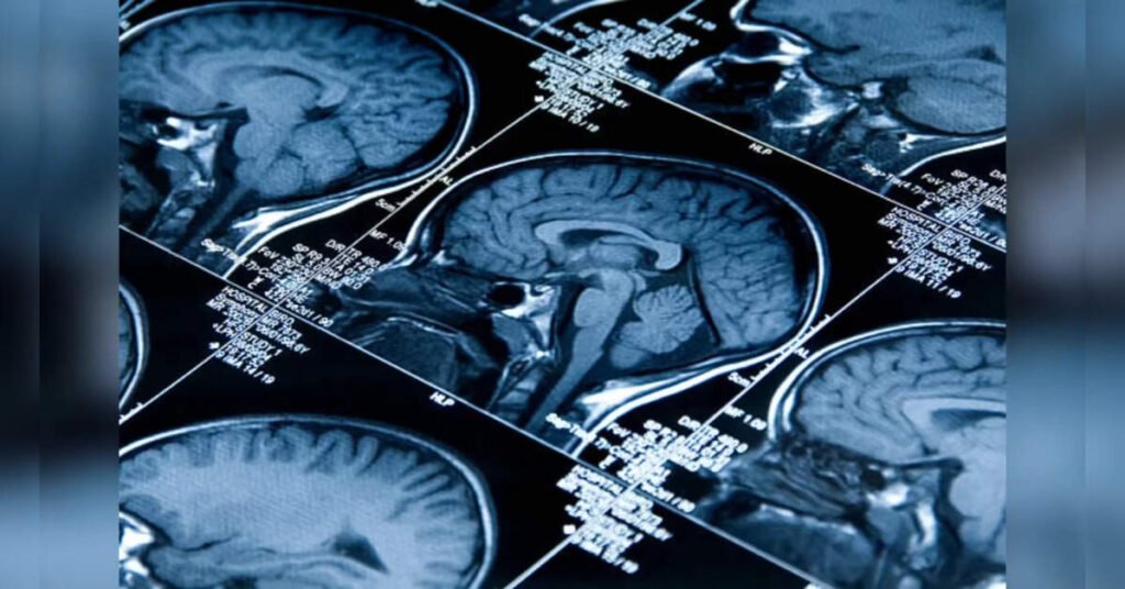 Mapping How Different Brain Regions Age Unequally, ETHealthworld