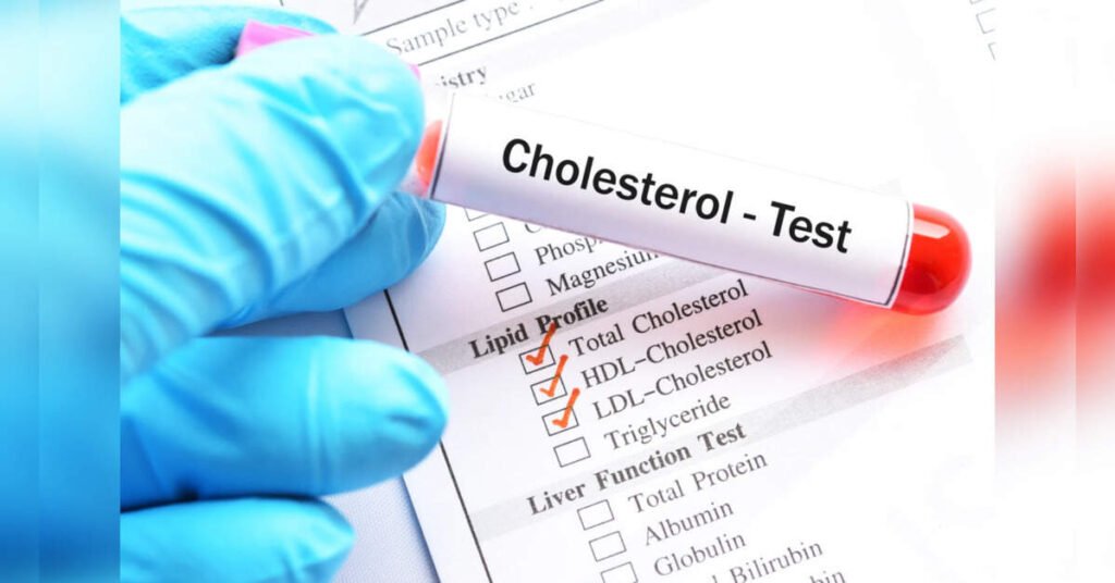 One-third of global ‘bad’ cholesterol burden occurred in India, China in 2023: Study, ETHealthworld
