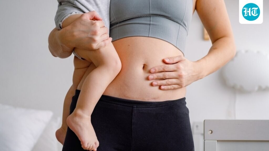 Postpartum pain is NOT just ‘normal’: Physiotherapist Muskan Rastogi reveals all about pelvic floor recovery