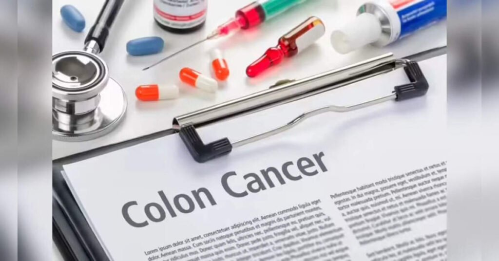 Revolutionary Blood Test Detects Pre-Cancerous Colorectal Lesions Early, ETHealthworld Revolutionary Blood Test Detects Pre-Cancerous Colorectal Lesions Early, ETHealthworld
