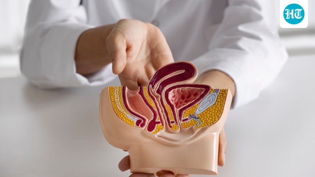 Why more young adults are being diagnosed with colon cancer: Oncologist Dr Ravi K Gupta shares risk factors and symptoms Why more young adults are being diagnosed with colon cancer: Oncologist Dr Ravi K Gupta shares risk factors and symptoms