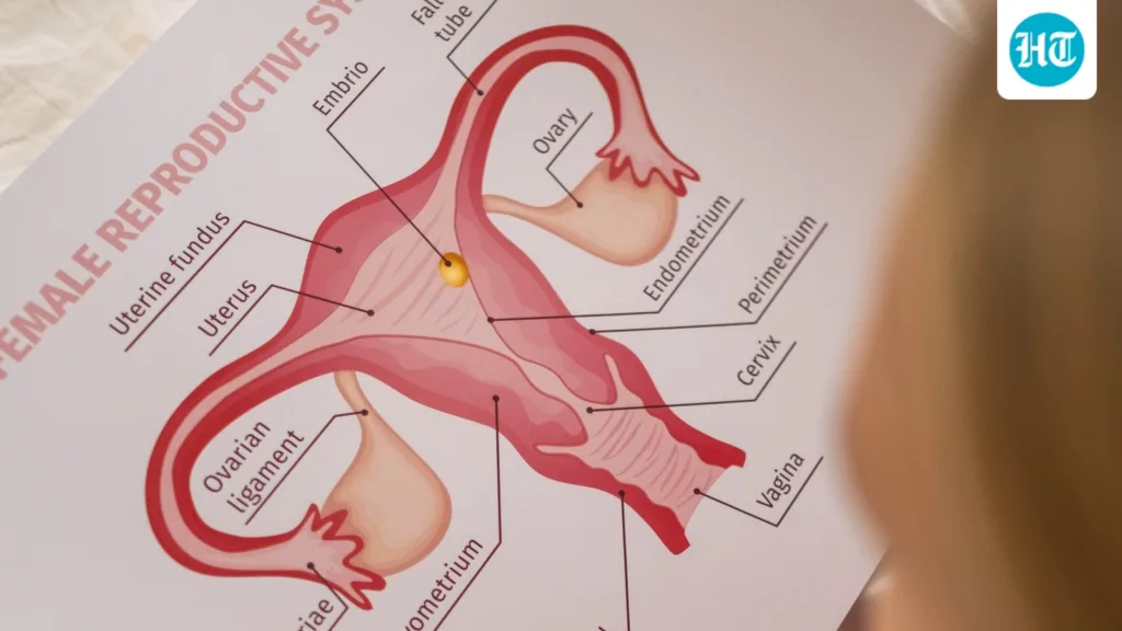Have PCOS and trying to get pregnant? Here’s what you should know before considering IVF Have PCOS and trying to get pregnant? Here’s what you should know before considering IVF