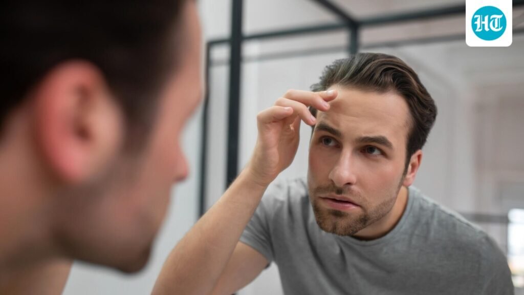 National Hair Day: A dermatologist explains why men are experiencing hair loss in their 20s and 30s. National Hair Day: A dermatologist explains why men are experiencing hair loss in their 20s and 30s.