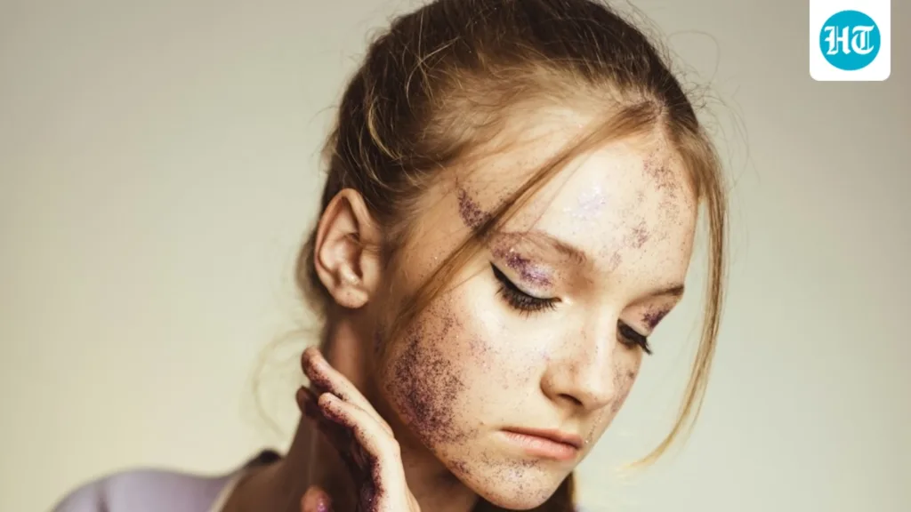 Not all acne scars are the same: How to identify your scar type and understand what your skin needs Not all acne scars are the same: How to identify your scar type and understand what your skin needs