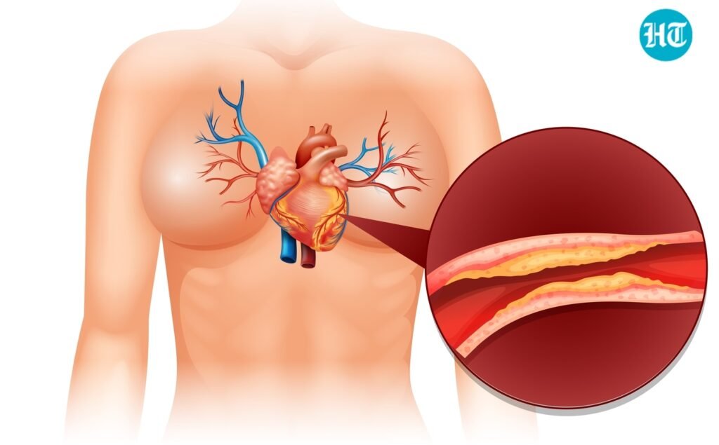 5 ‘bad’ cholesterol myths busted: Cardiologist explains why feeling fine doesn’t mean your heart is safe