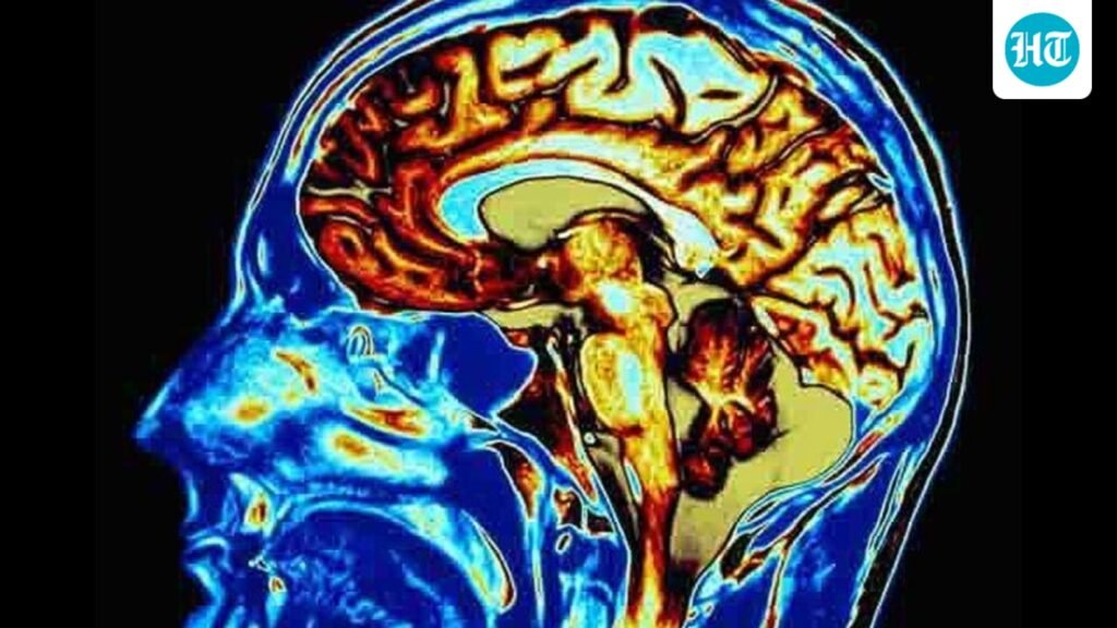 Is your forgetfulness a red flag? Neurologist warns of these signs that should never be ignored