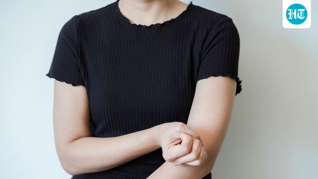 Itching and hives for more than 6 weeks? Dermatologist shares 5 signs that it is not an allergic reaction but a chronic condition Itching and hives for more than 6 weeks? Dermatologist shares 5 signs that it is not an allergic reaction but a chronic condition