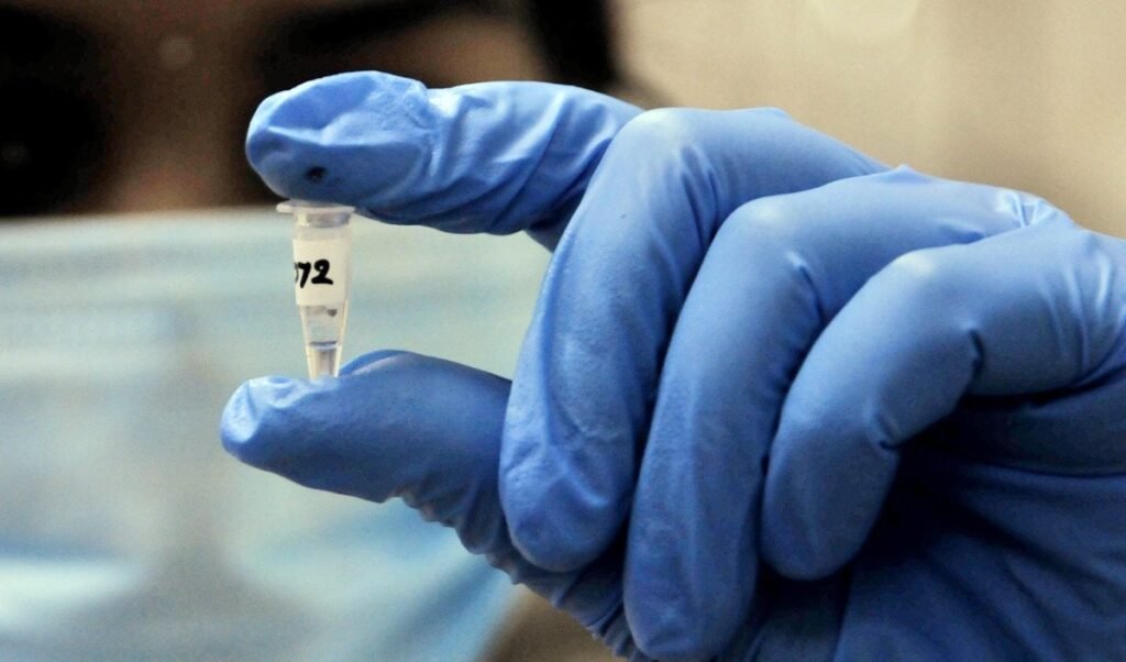 Russia Mysterious Virus | हाथ से छूटी 'बायोलॉजिकल' टेस्ट ट्यूब और तड़प-तड़प कर हुई मौत! रूस से आई वायरस लीक होने की खबर से पूरी दुनिया में दहशत