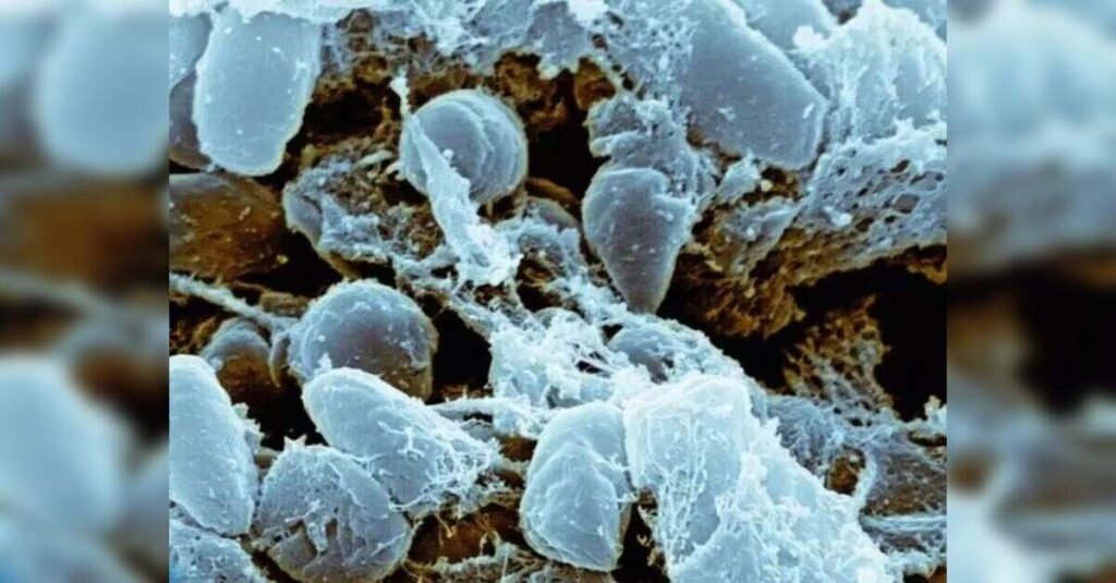 Symptoms, Spread, and Global Impact Amid Siberia’s Mysterious Illness, ETHealthworld Symptoms, Spread, and Global Impact Amid Siberia’s Mysterious Illness, ETHealthworld