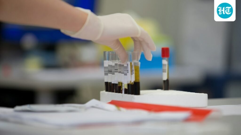 Tired, low mood, PCOS or acne? Dietician shares 9 blood tests your regular checkup may miss